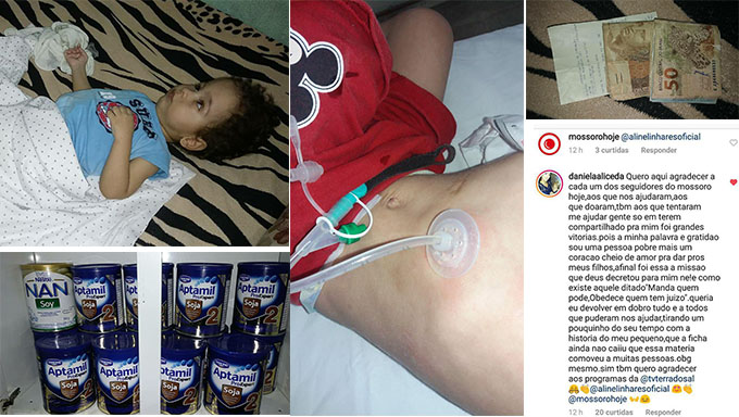   Com a sonda nova, alimentação adequada João Gabriel não chora mais e também se mostra bem mais confortável; a mãe Daniele Alice agradece pela ajuda dos leitores do MOSSORO HOJE e da TV Terra do Sal