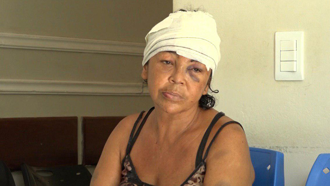   Flávia Regina do Nascimento sofreu várias escoriações e levou diversos pontos na cabeça. 
