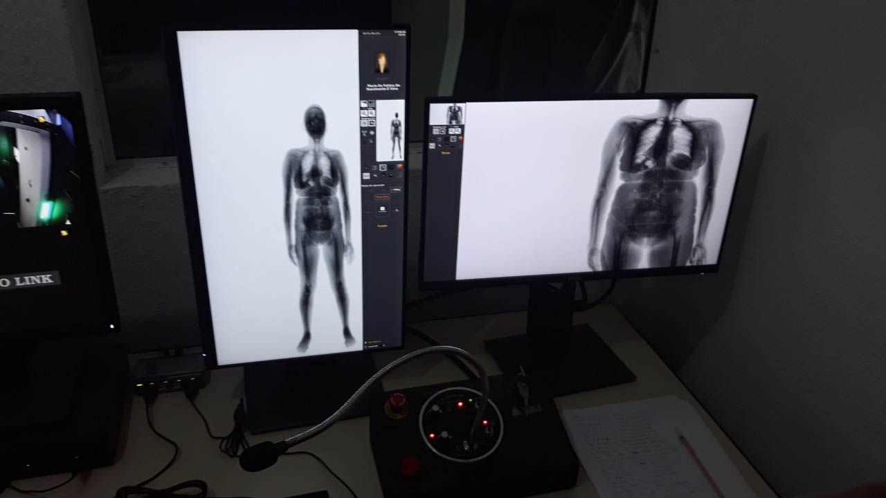   Penitenciária Estadual de Alcaçuz passa a utilizar “body scan”. O equipamento utilizado para realizar escaneamento corporal vai auxiliar os agentes penitenciários na detecção de objetos proibidos nos dias de visitas.