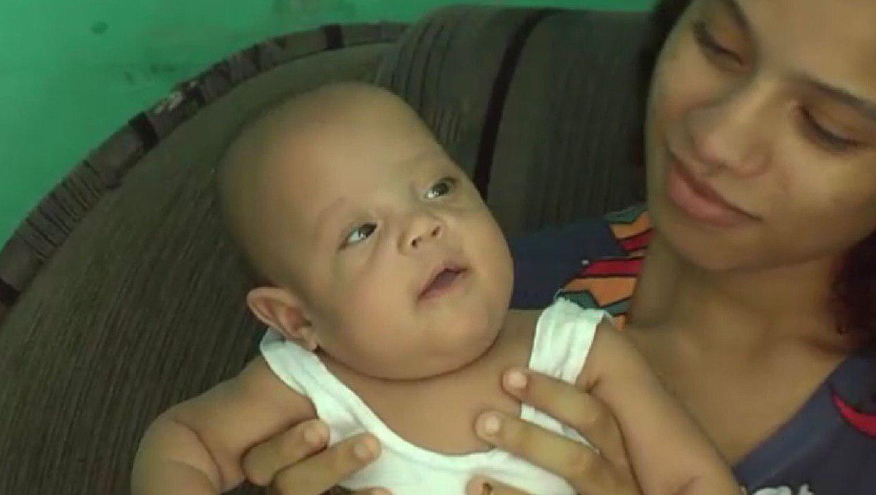   Bebê de 5 meses precisa de cirurgia no valor de R$ 20 mil para não ficar cega.