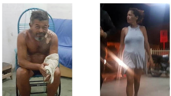  Acusada teve parte do braço e ombros queimados pelo óleo quente. A acusada Wigna Morais foi presa na época e autuada; Hoje senta no banco dos réus