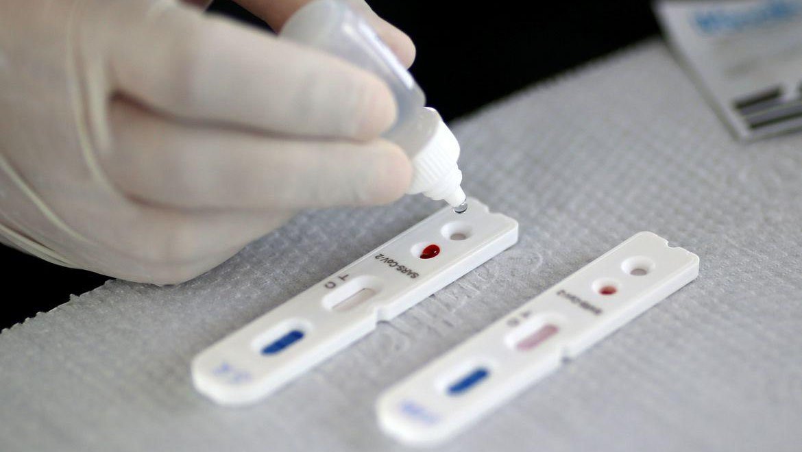   RN passa dos 50 mil casos positivos para Covid-19; Mossoró passa dos 5 mil. De acordo com o boletim epidemiológico da Sesap, nesta sexta-feira (31) o número de casos positivos para a doença chegou a 50.416. Já o número de óbitos provocados pela Covid-19 são 1.777 e outros 185 em investigação; Em Mossoró, na véspera de reabertura do shopping, a cidade registrou 5.061 positivos da doença.