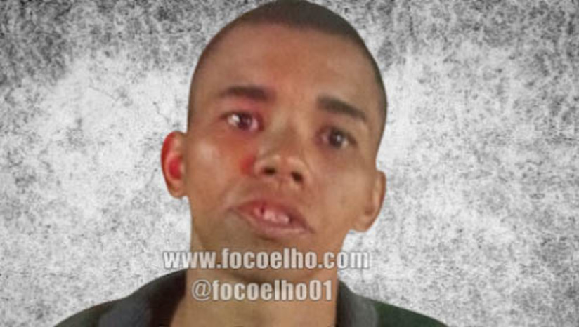 Imagem 1 -  