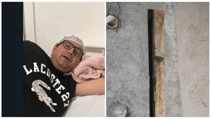Imagem 1 -  Homem que agrediu o prefeito de Florânia a pauladas é preso em Tenente Laurentino Cruz. A prisão de Ailton Queiroz aconteceu por volta das 19h desta segunda-feira (24). Contra ele havia uma mandado de prisão preventiva pelos crimes de lesão corporal e roubo. No domingo (23), ele teria agredido a pauladas o prefeito do município de Florânia, Saint-Clay Alcântara, durante uma visita que o gestor fazia às obras de um calçamento. Em seguida, o suspeito teria fugido levando o celular do prefeito. O delegado responsável pelas investigações informou à reportagem do MOSSORÓ HOJE que as investigações sobre o caso continuam, pode haver, no decorrer do processo, mudança na capitulação penal a qual o agressor foi enquadrado.