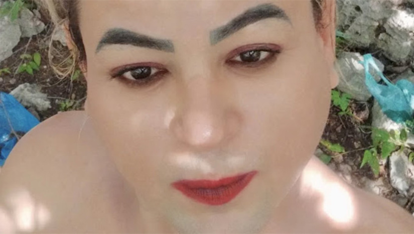 Imagem 1 - Segundo os peritos, Alcélio foi assassinado com um disparo de arma de fogo no rosto, desfazendo rumores iniciais de que ele teria sido morto a pedradas. Era muito conhecido na região, pelo forma gentil como atendias as pessoas enfermas no Hospital Regional Helio Morais Marinho, em Apodi. Imagem 1 - Segundo os peritos, Alcélio foi assassinado com um disparo de arma de fogo no rosto, desfazendo rumores iniciais de que ele teria sido morto a pedradas. Era muito conhecido na região, pelo forma gentil como atendias as pessoas enfermas no Hospital Regional Helio Morais Marinho, em Apodi.