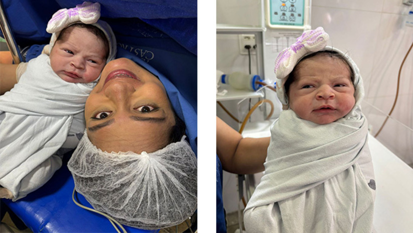 Imagem 1 - O parto foi realizado no Hospital Maternidade Almeida Castro, em Mossoró-RN. Maitê nasceu de parto cesáreo, medindo 47cm e pesando 3,658 quilos, sob os cuidados dos obstetras Tiago Menezes e Clélio Sena, com auxílio do anestesiologista Daniel Queiroz, para a felicidade dos pais Jhonatan Gomes de Oliveira e Mariele Monique de Oliveira, residentes no município de Assu-RN. Imagem 1 - O parto foi realizado no Hospital Maternidade Almeida Castro, em Mossoró-RN. Maitê nasceu de parto cesáreo, medindo 47cm e pesando 3,658 quilos, sob os cuidados dos obstetras Tiago Menezes e Clélio Sena, com auxílio do anestesiologista Daniel Queiroz, para a felicidade dos pais Jhonatan Gomes de Oliveira e Mariele Monique de Oliveira, residentes no município de Assu-RN.