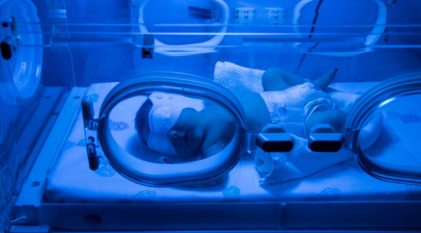   O Ministério Público do Rio Grande do Norte entrou com uma ação na Justiça para obrigar o Estado a organizar o atendimento de recém-nascidos com icterícia neonatal em Pau dos Ferros. A falta de estrutura e de especialistas na rede pública local tem gerado recusa de atendimento, colocando os bebês em risco de sofrer sequelas neurológicas permanentes. O órgão pede uma decisão liminar imediata para garantir o tratamento por fototerapia na própria cidade.