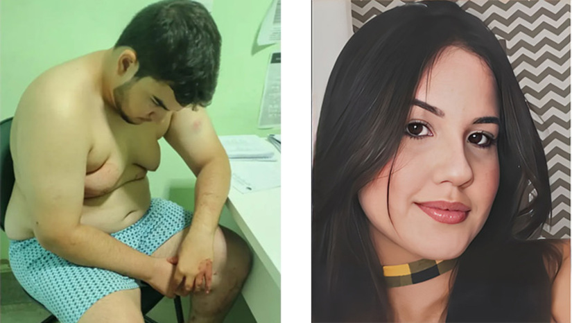   Um crime bárbaro aconteceu durante a madrugada desta segunda-feira, 26, na cidade de Umarizal, após a vítima participar da festa da vitória de Lula. Clara Maia sofreu três facadas — uma delas na garganta — e se encontra na UTI do Hospital de Pau dos Ferros. Eduardo Ronald foi preso em flagrante e, nesta terça-feira, 27, a Justiça decretou sua prisão preventiva para garantir a ordem pública, a conveniência da instrução processual e devido à conduta reprovável do réu, além do fato de o local do crime ter sido manipulado pela família.