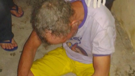   Morador de rua é agredido com pedrada na cabeça em Mossoro